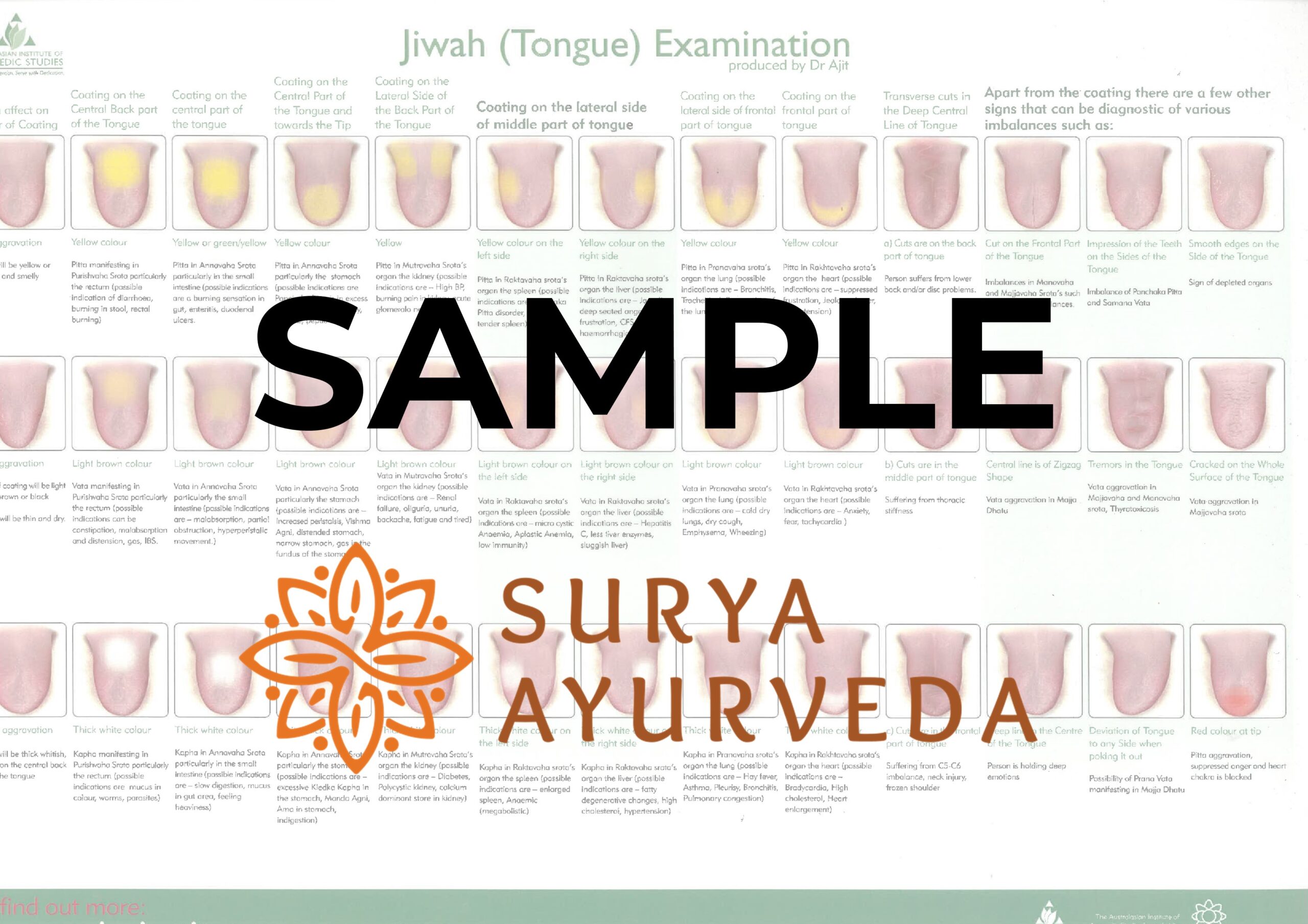 Tongue Diagnosis Chart New Style Surya Ayurveda